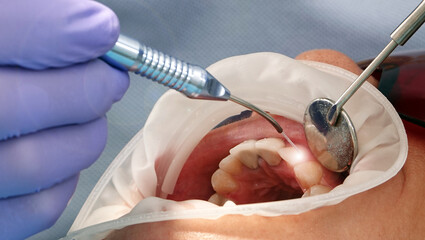 Dentist doctor working with patient