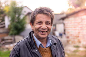 Gypsy man with rotten teeth