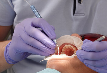 Dentist doctor works with a laser