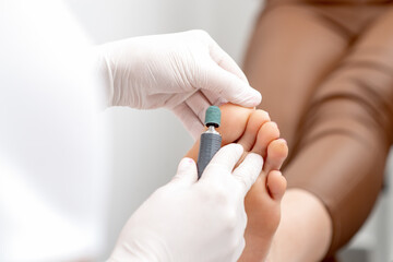 Peeling feet pedicure procedure from callus on foot by hands of podiatrist in white gloves at...