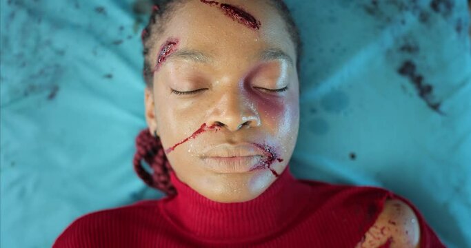 Top view of afro american girl with blood and head wound riding to hospital. Young woman lying on medical transportation cart in ambulance. Concept of healthcare