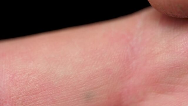Closeup panning shot of the skin and hair of a man's finger. Macro shot showing all the details