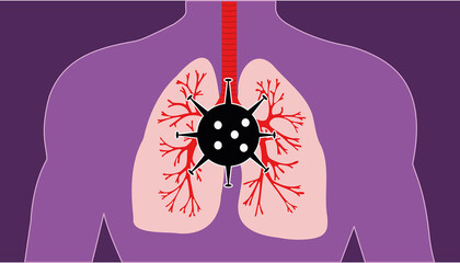 Virus infects human lungs.