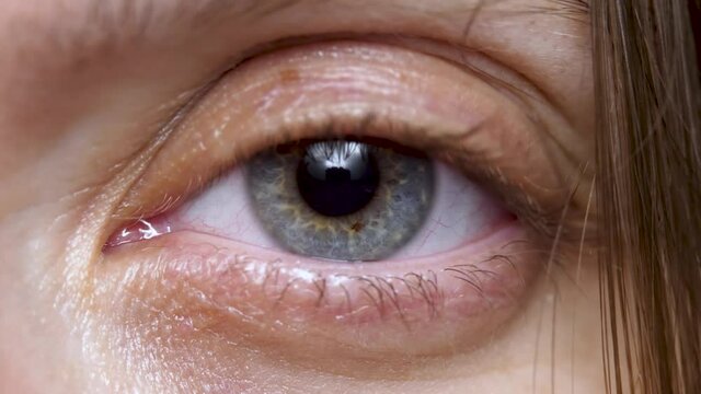 Cute woman open grey eye, pupil with iris. Pretty female smile, positive emotion. Natural skin no make up. Wrinkle around eye is fold, ridge or crease on skin. Cosmetology and skincare
