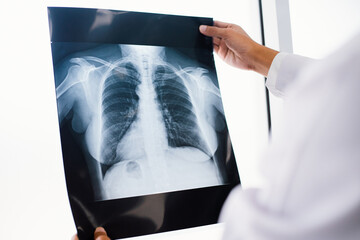 Radiology doctor examining at chest x ray film of patient at health care clinic