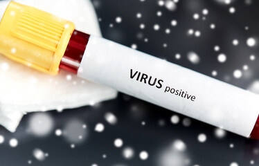 medicine, healthcare and pandemic concept - close up of beaker with positive virus blood test on table at laboratory in winter over snow