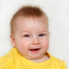 Fototapeta premium eye infection conjunctivitis in a newborn baby