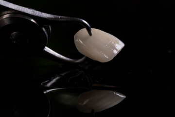 
 Porcelain veneer closeup on black background, isolate