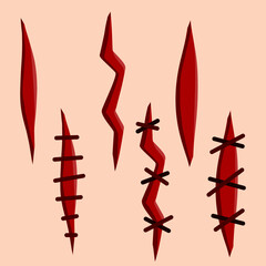 Bloody wound. Set of scratches. Stitches and medical care. Template for skin injury. A Bleeding Cut. Flat cartoon illustration