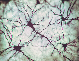 Axons Neurotransmission Central Nervous System