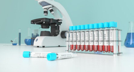 Coronavirus Covid-19 blood testing in a lab. Covid medical screening. Blood samples in glass test...
