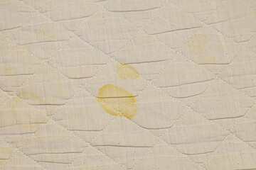 Yellow urine stain on a white bed quilt