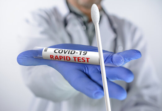 Medical has a Rapid test Coronavirus COVID-19
