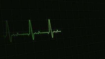 Green colored heart rate or heart beat line. Cardiogram signal monitoring. Isolated on black. Patient's vital signs. EKG, ECG curve. Pulse measuring. Medical Cardiological illustration. Life support