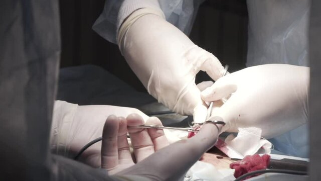 Close up of genitals of a patient who has testicular cancer. Action. Surgeons cutting out a tumor from male tescticle in the operating room in a hospital.