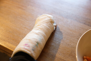 Little boy with a broken wrist at the table. Boy with a plaster on his arm.