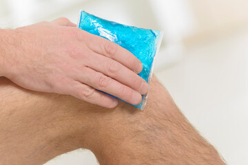 Cold gel compress on the knee