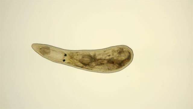 worm Gyratrix hermaphroditus under a microscope, Polycystididae family, Turbellaria class, is a cosmopolitan living in both fresh and salt water. Sample found at Lake Baikal