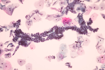 View in microscopic of normal human cervix cells.Squamous epithelium cells and glandular epithelial cells.Cytology and pathology laboratory department.Magnification 400 X