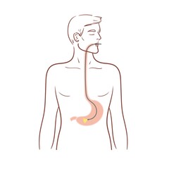 Fototapeta premium Gastroscopy of the stomach. Esophagoscopy,diagnostic procedure.A man is undergoing a medical examination. Stock isolated illustration on white background.