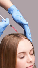 Doctor hands in protective medical gloves. Hair injection. Pretty young woman. Face anti age...