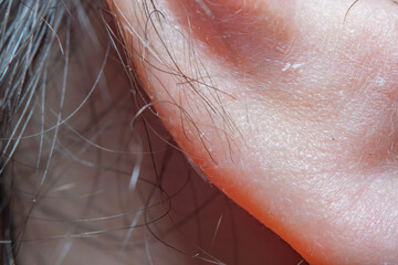 Close-up of part of the male ear in soft focus with strong magnification under the microscope. Concept - Hearing Preservation and Health Care