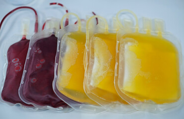 packed red cell (PRC) and fresh frozen plasma (FFP) bags for blood transfusion 
