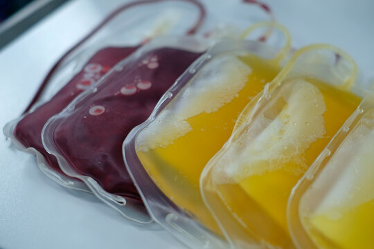 packed red cell (PRC) and fresh frozen plasma (FFP) bags for blood transfusion 