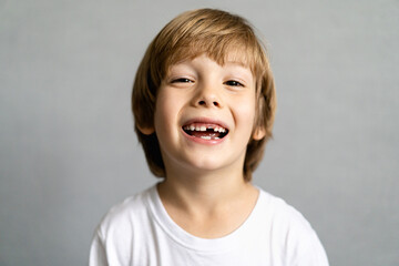 cute blonde boy without teeth, baby teeth fell out, children's medicine concept dentistry