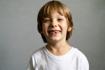 cute blonde boy without teeth, baby teeth fell out, children's medicine concept dentistry