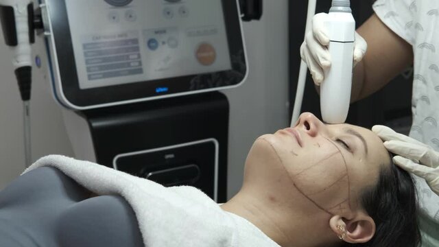 Woman receiving HUFU therapy- high intensity focused ultrasound treatment on face. Therapist doing non-surgical cosmetic plasma lift on female client forehead with ultrasonic device. SMAS lifting