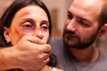 Husband traumatising wife after beating and making her face full of bruises. Violent aggressive husband abusing injuring terrified helpless, vulnerable, afraid, beaten and panicked wife.