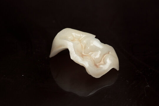 porcelain, veneers, ceramicteeth, dental treatment, tab, onlay, dentistry, dentist, smile, beautiful teeth
