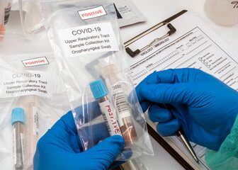 Nurse analyses positive PCR tests of covid-19 in a hospital laboratory, conceptual image