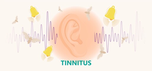 Tinnitus disorder a ringing sound in the ear hearing loss wave level anxiety test assist exam inner exposure problem circulatory nerves hair cell canal Earwax - obrazy, fototapety, plakaty