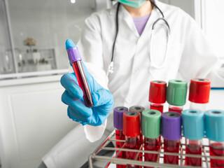 Scientists hold the blood tube to do testing or research and analysis in a laboratory.