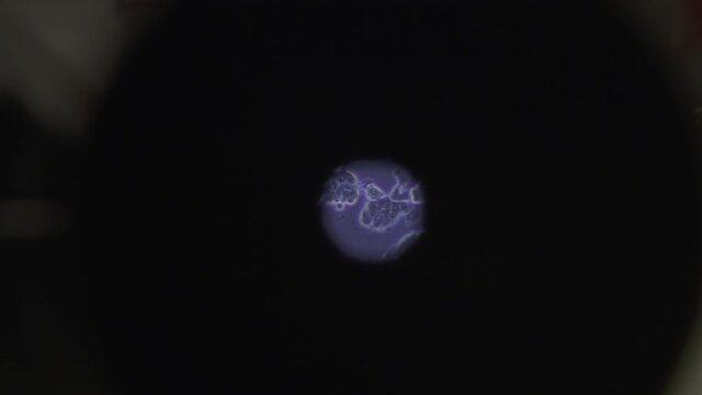 Microscopic View Of Unseen Bacterias - FOV (field of view)