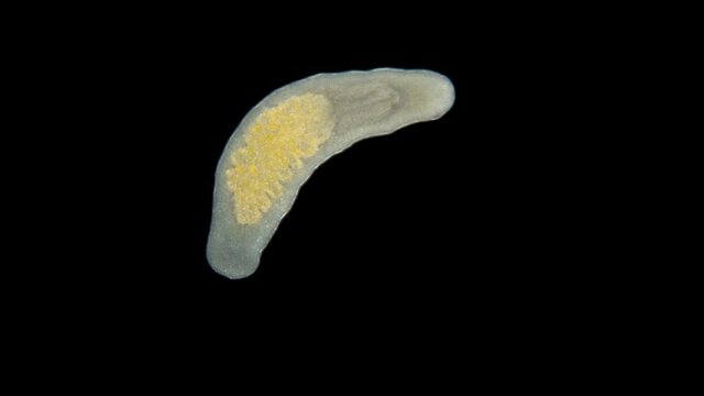 The flatworm Macrostomum sp. under a microscope, of the family Macrostomidae, Platyhelminthes Phylum, a sample was found on Lake Baikal.