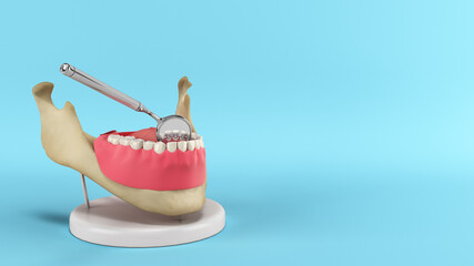 Lingual braces system on a demonstration denture 3d render on blue background