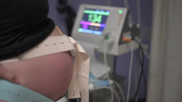 A Cardiotocograph CTG machine monitors a heavily pregnant woman's unborn baby's heartbeat in the hospital while in active labour.