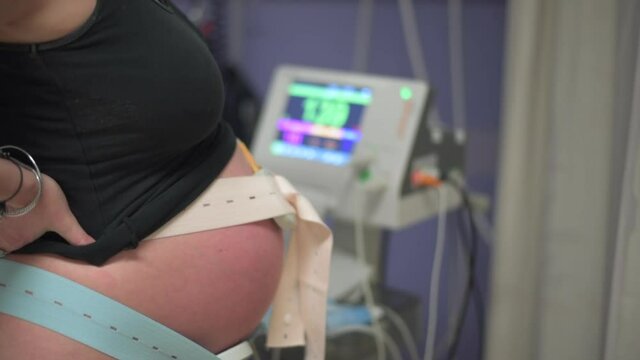 A Cardiotocograph machine monitors a heavily pregnant woman's unborn baby's heartbeat in the hospital while in active labour.