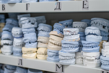 Warehouse of plaster models of human jaws in an orthodontic clinic. Control and diagnostic dental casts for aligners.
