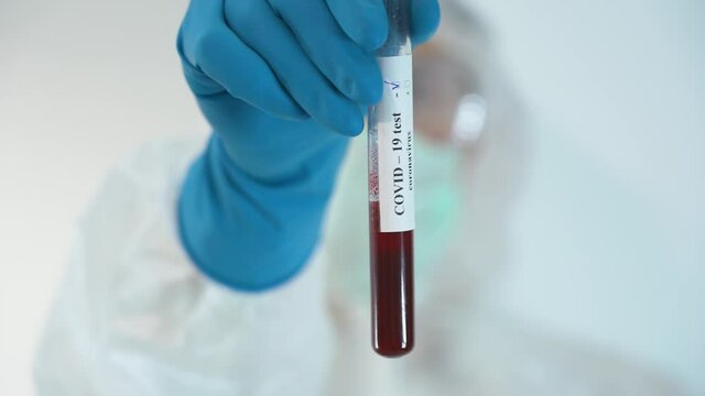 Confident young man wear protective medical suit, disposable face mask, glasses, hood on head, blue rubber gloves, shows glass test tube with negative result on covid-19 close-up on white background.