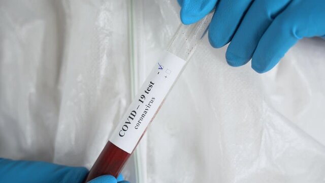Medic man wear protective anti-virus white suit, blue rubber gloves, holds test tube with sample blood, negative result by covid-19 corona virus close up. Scientist makes testing of infected patients.
