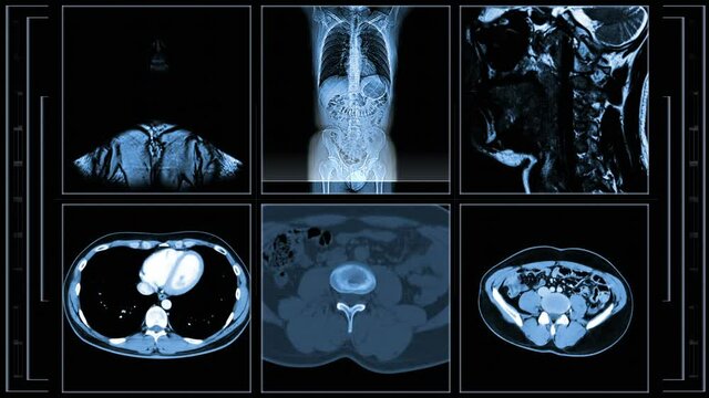 Human MRI. The video is looping without breaks.