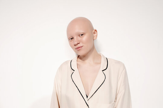 Young hairless woman standing against white background