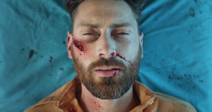 Guy with serious injuries mumbling while lying on hospital stretcher in ambulance. Close up view of bearded man with blood and wounds being transportating to clinic.Concept of accident