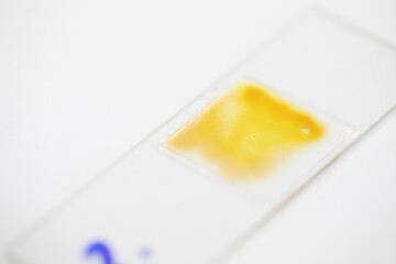 Finding parasites in feces in laboratory.
