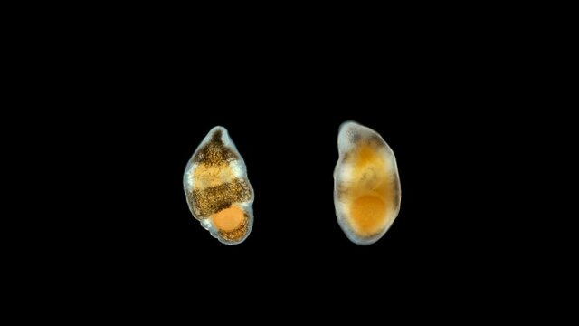 A flatworm from the order Proseriata under a microscope. Phylum Platyhelminthes. Sample found at Lake Baikal