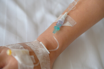 Patient's hand with Total Parenteral Nutrition (TPN) being administered into vein